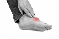 Signs You May Have Developed Gout