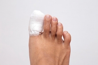 Two Types of Toe Fractures