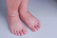 Foot Pain and Pregnancy
