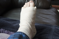 Surgery for a Broken Foot
