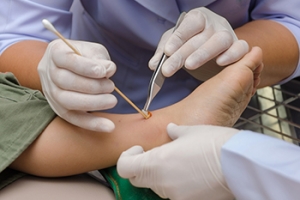 Why Chronic Foot Wounds Do Not Heal and What Helps