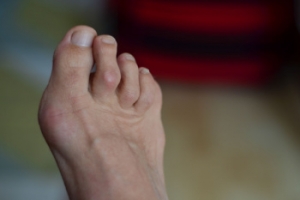 Family Traits and Foot Shape Changes